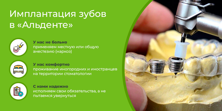 Имплантация зубов в Минске