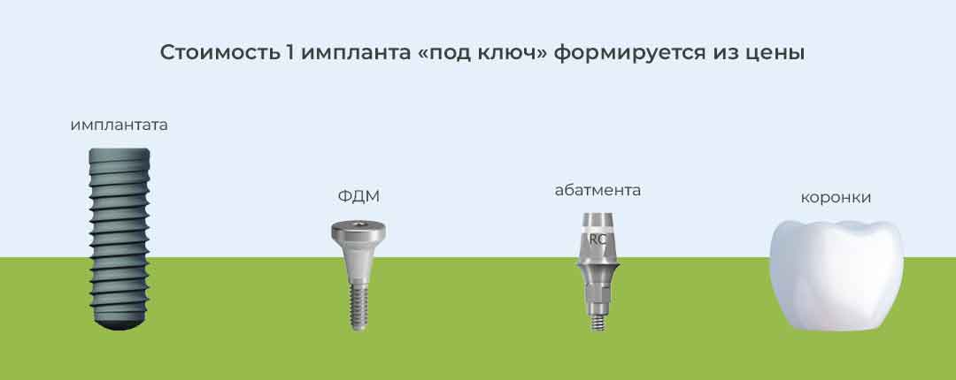 Стоимость 1 импланта под ключ в Минске складывается из цены имплантата, фдм, абатмента и коронки