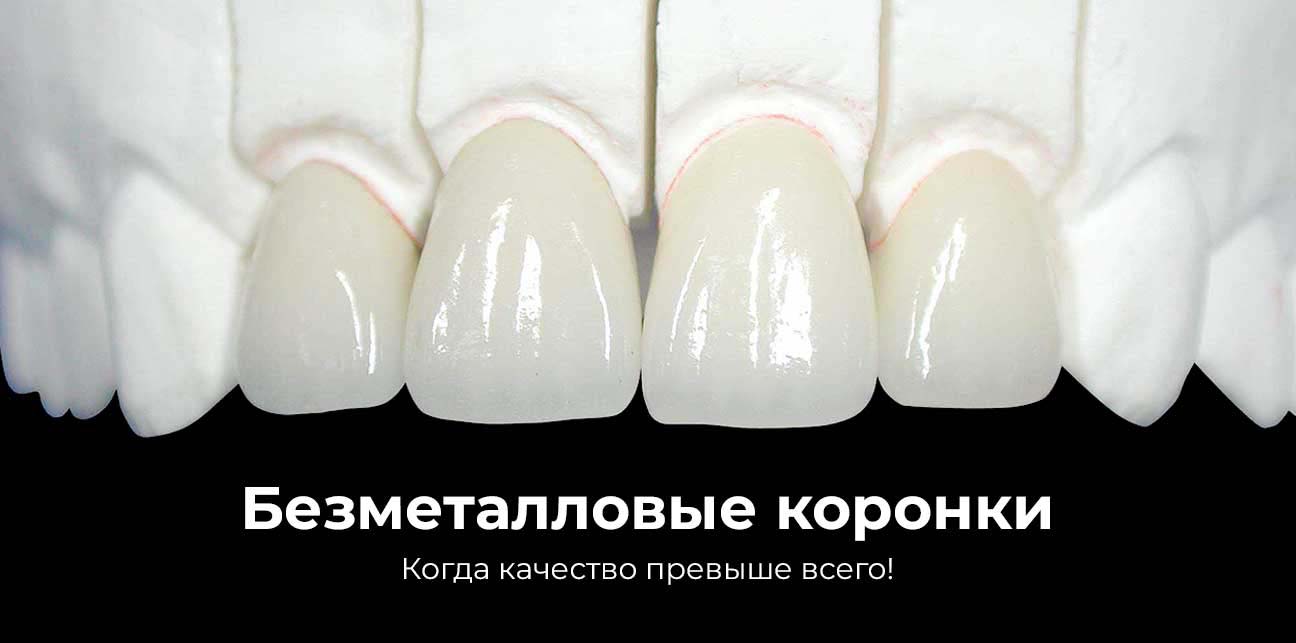 Цена безметалловой коронки в Минске