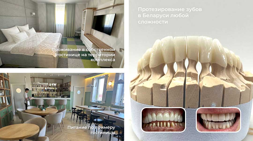 Протезирование в Белоруссии с проживанием и питанием, цены